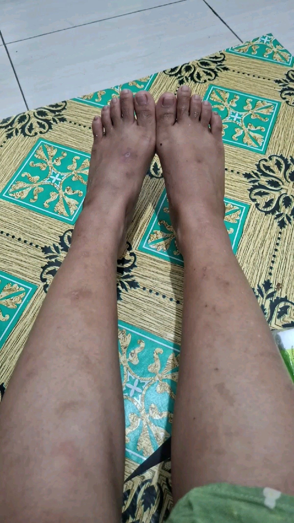 Dewi — Before
